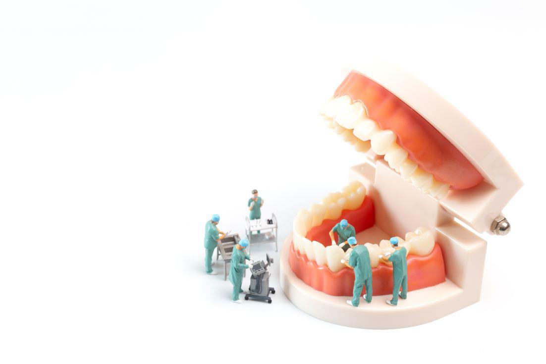 Dental Implant Maintenance